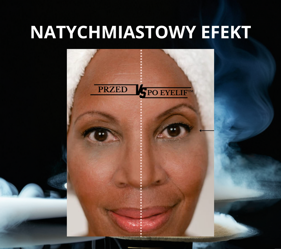 EyeLift™  Podnieś powieki w 30 sekund (96 szt.)